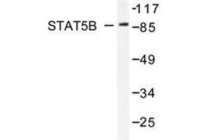Western blot analysis of Stat5b antibody in extracts from HeLa cells. (STAT5B antibody)