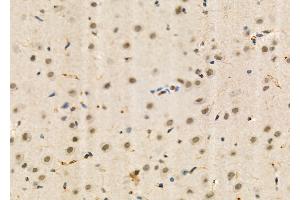 ABIN6260309 and ABIN6273995 at 1/100 staining Rat brain tissue by IHC-P. (BRD4 antibody  (N-Term))