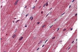 Human Heart: Formalin-Fixed, Paraffin-Embedded (FFPE) (CPN1 antibody  (AA 251-300))