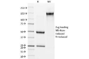 SDS-PAGE Analysis Purified Involucrin Mouse Monoclonal Antibody (SY5). (Involucrin antibody)
