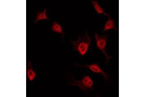 ABIN6274539 staining 293 by IF/ICC. (ZC3H7B antibody  (C-Term))