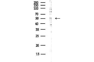 anti-T-Box 20 (TBX20) antibody