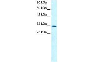 WB Suggested Anti-KLF8 Antibody Titration: 0. (KLF8 antibody  (N-Term))