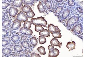 IHC analysis of TTC11/FIS1 using anti-TTC11/FIS1 antibody (ABIN7600321).