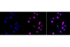 Immunocytochemical staining of HepG2 cells with MTA2 antibody (ABIN7799378), 1:1,000). (Recombinant MTA2 antibody)