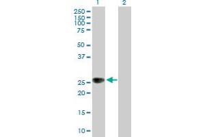 Western Blot analysis of ZNRF1 expression in transfected 293T cell line by ZNRF1 MaxPab polyclonal antibody. (ZNRF1 antibody  (AA 1-227))