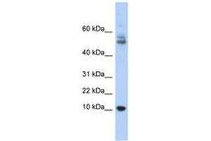 Image no. 1 for anti-Myotrophin (MTPN) (AA 35-84) antibody (ABIN6743678) (MTPN antibody  (AA 35-84))