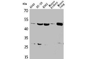 Western Blot analysis of A549 HT29 K562 mouse kidney mouse lung cells using GDI-2 Polyclonal Antibody (GDI2 antibody  (C-Term))