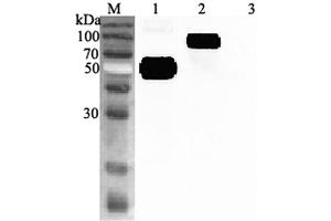 Western blot analysis using anti-ST2 (human), pAb  at 1:2'000 dilution.