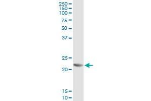 Immunoprecipitation of RCVRN transfected lysate using anti-RCVRN monoclonal antibody and Protein A Magnetic Bead , and immunoblotted with RCVRN MaxPab rabbit polyclonal antibody. (Recoverin antibody  (AA 101-199))