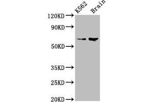 Western Blot Positive WB detected in: K562 whole cell lysate, Rat brain tissue All lanes: BRAP antibody at 7. (BRAP antibody  (AA 13-124))