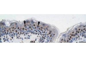 Rabbit Anti-GTF21 Antibody ,Paraffin Embedded Tissue: Human Skin  Cellular Data: Squamous epithelial cells  Antibody Concentration: 4. (GTF2I antibody  (N-Term))