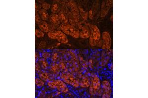 Immunofluorescence analysis of Mouse kidney using MIOX Rabbit pAb (ABIN7268729) at dilution of 1:100. (MIOX antibody  (AA 1-285))