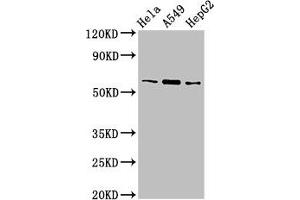 Western Blot Positive WB detected in: Hela whole cell lysate, A549 whole cell lysate, HepG2 whole cell lysate All lanes: TBL1X antibody at 3 μg/mL Secondary Goat polyclonal to rabbit IgG at 1/50000 dilution Predicted band size: 63, 58 kDa Observed band size: 63 kDa