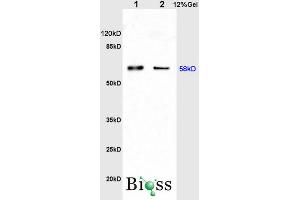 L1 rat kidney lysates L2 rat brain lysates probed with Anti Catalase Polyclonal Antibody, Unconjugated (ABIN872991) at 1:200 in 4 °C. (Catalase antibody  (AA 251-350))