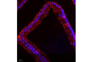 Immunofluorescence of paraffin embedded rat prostate using MYL6 (ABIN7074734) at dilution of 1:650 (400x lens) (MYL6 antibody)