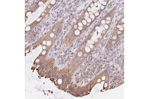 Immunohistochemical staining of human rectum with FAM208B polyclonal antibody  shows moderate cytoplasmic positivity in glandular cells at 1:50-1:200 dilution. (FAM208B antibody)