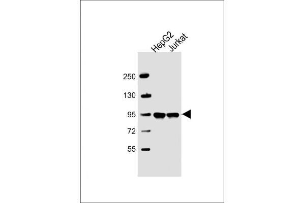 PPFIBP1 anticorps  (AA 588-617)