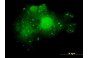 Immunofluorescence of monoclonal antibody to ALDOA on A-431 cell. (ALDOA antibody  (AA 1-364))