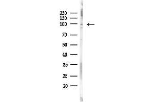 anti-Signal Transducer and Activator of Transcription 2, 113kDa (STAT2) (pThr387) antibody