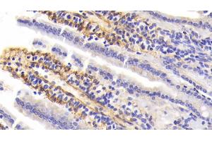 Detection of PIIINP in Mouse Small Intestine Tissue using Polyclonal Antibody to Procollagen III N-Terminal Propeptide (PIIINP) (PIIINP antibody  (AA 24-154))