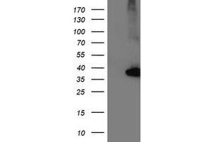 Western Blotting (WB) image for anti-Nudix (Nucleoside Diphosphate Linked Moiety X)-Type Motif 18 (NUDT18) antibody (ABIN1499862) (NUDT18 antibody)