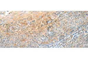 Immunohistochemistry of paraffin-embedded Human tonsil tissue using CLEC3B Polyclonal Antibody at dilution of 1:90(x200)