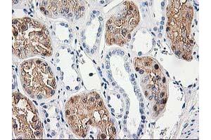 Immunohistochemical staining of paraffin-embedded Human Kidney tissue using anti-ACY1 mouse monoclonal antibody. (Aminoacylase 1 antibody)