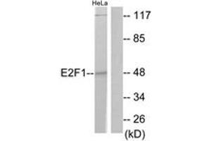 Western blot analysis of extracts from HeLa cells, treated with Etoposide 25uM 24h, using E2F1 (Ab-433) Antibody. (E2F1 antibody  (AA 388-437))