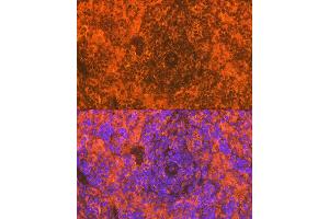 Immunofluorescence analysis of rat spleen using CD83 Rabbit mAb (ABIN7266223) at dilution of 1:100 (40x lens). (CD83 antibody)