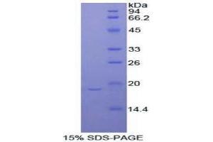 SDS-PAGE (SDS) image for Periostin (POSTN) (AA 659-810) protein (His tag) (ABIN2121828)