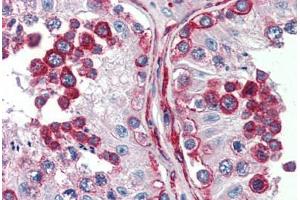 Immunohistochemistry (Paraffin-embedded Sections) (IHC (p)) image for anti-Discs, Large Homolog 4 (Drosophila) (DLG4) (C-Term) antibody (ABIN396947)