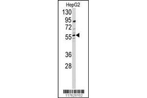 Western blot analysis of anti-DHCR24 Antibody in HepG2 cell line lysates (35ug/lane) (Seladin 1 antibody  (N-Term))