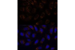 Immunofluorescence analysis of U-2 OS cells using R antibody (ABIN6132582, ABIN6146672, ABIN6146673 and ABIN6222096) at dilution of 1:100.