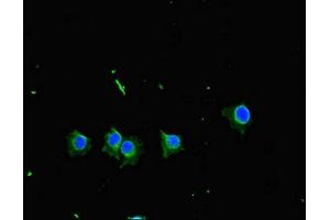 Immunofluorescence (IF) image for anti-TANK-Binding Kinase 1 (TBK1) (AA 364-585) antibody (ABIN7169195)