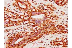 Immunohistochemistry (IHC) image for anti-Protein Kinase C and Casein Kinase Substrate in Neurons 2 (PACSIN2) (AA 240-410) antibody (ABIN7165686)