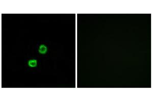 Immunofluorescence analysis of MCF-7 cells, using GCNT7 antibody. (GCNT7 antibody  (C-Term))