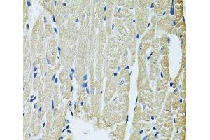 Immunohistochemistry of paraffin-embedded Rat heart using SLC5A6 Polyclonal Antibody at dilution of 1:100 (40x lens).