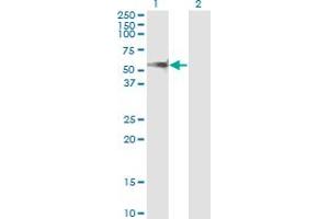 Western Blot analysis of PPM1F expression in transfected 293T cell line by PPM1F monoclonal antibody (M02), clone 1G10. (PPM1F antibody  (AA 1-100))
