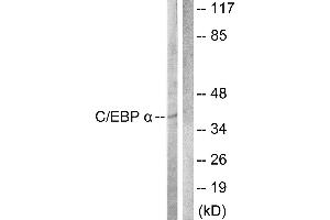 Western blot analysis of extracts from COS7 cells, treated with EGF (200ng/ml, 30mins), using C/EBP-α (Ab-222) antibody. (CEBPA antibody  (Thr222))