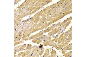 Immunohistochemistry of paraffin-embedded Rat heart using PEX5 antibody at dilution of 1:100 (x400 lens).