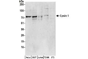 Western Blotting (WB) image for anti-Epsin 1 (EPN1) (AA 375-425) antibody (ABIN7450216)
