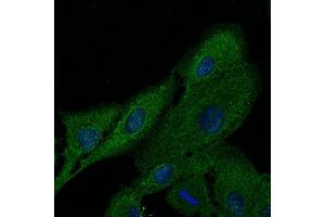 Immunofluorescence - anti-FTCD Ab at 1/100 dilution in NHl/3T3 cells were fixed with methanol and permeabilized With 0. (FTCD antibody  (N-Term))