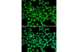 Immunofluorescence analysis of U2OS cells using ARRB2 antibody. (Arrestin 3 antibody)