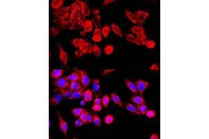 Immunofluorescence analysis of HeLa cells using TRPC6 antibody (ABIN7270918) at dilution of 1:100 (40x lens). (TRPC6 antibody  (AA 732-931))