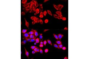Immunofluorescence analysis of HeLa cells using TRPC6 antibody (ABIN7270918) at dilution of 1:100 (40x lens). (TRPC6 antibody  (AA 732-931))