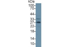 Western Blot; Sample: Human Hela cell lysate; Primary Ab: 2µg/ml Rabbit Anti-Gallus ADP Antibody Second Ab: 0. (ADIPOQ antibody  (AA 32-244))