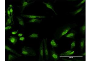 Immunofluorescence of purified MaxPab antibody to RANBP6 on HeLa cell.