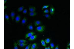 Immunofluorescent analysis of A549 cells using ABIN7156381 at dilution of 1:100 and Alexa Fluor 488-congugated AffiniPure Goat Anti-Rabbit IgG(H+L) (ITM2A antibody  (AA 79-263))
