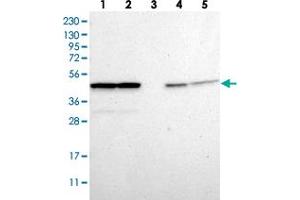 Western blot analysis of Lane 1: RT-4, Lane 2: U-251 MG, Lane 3: Human Plasma, Lane 4: Liver, Lane 5: Tonsil with PSMC5 polyclonal antibody  at 1:250-1:500 dilution.